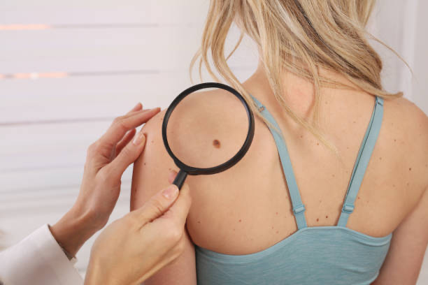 圖片來源：可商用圖庫
自我肌膚檢測的重要性！